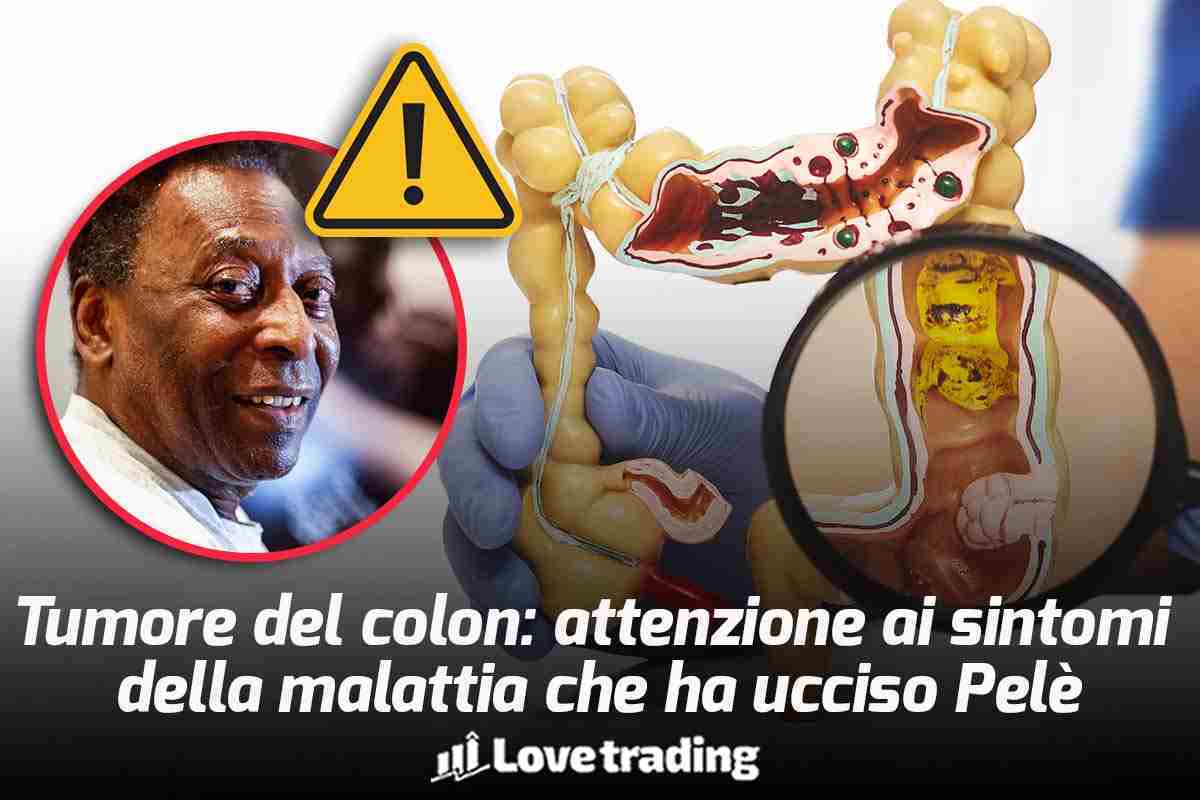 Pelè ed il tumore al colon