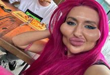 donna con gli zigomi più grandi del mondo