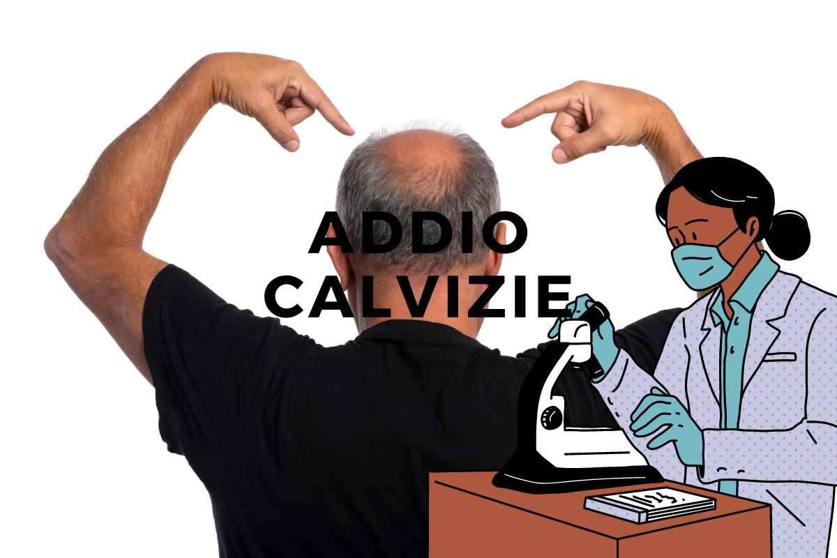 ricerca sulla calvizie