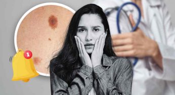 Guardati bene la pelle: quando i nei sono così vai dal dottore. Come riconoscere quelli a rischio