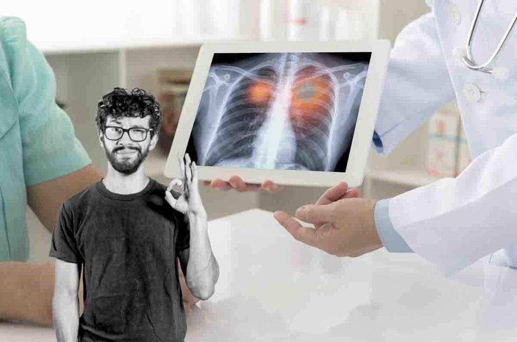Cancro polmoni