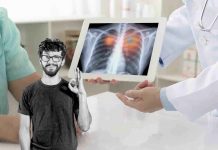 Cancro al polmone