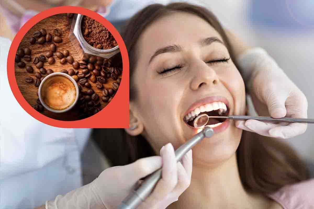 Igiene orale dal dentista